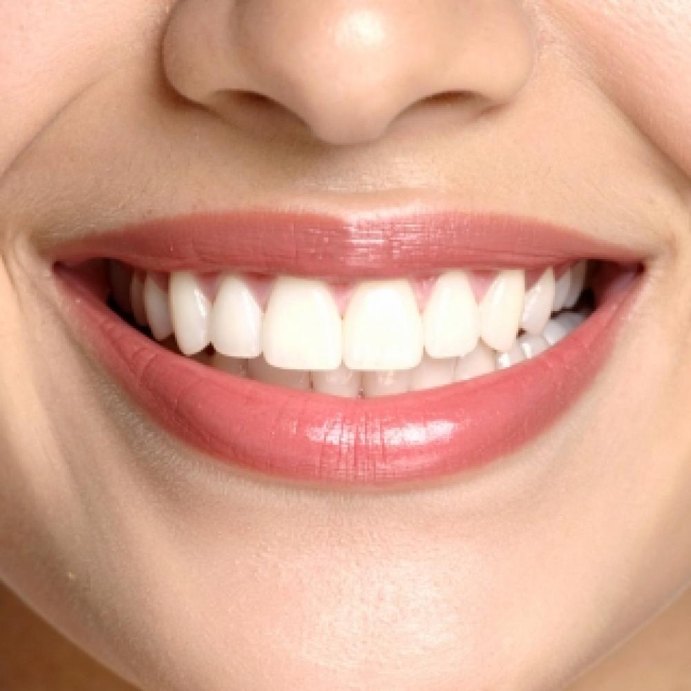 ابتسامة هوليوود في منزلك: كيف تبيض أسنانك بأمان دون حساسية؟