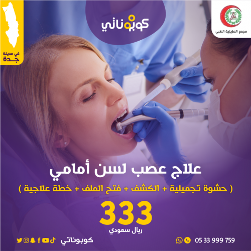 علاج عصب لسن امامي - مجمع العزيزية الطبي - جدة - ك...