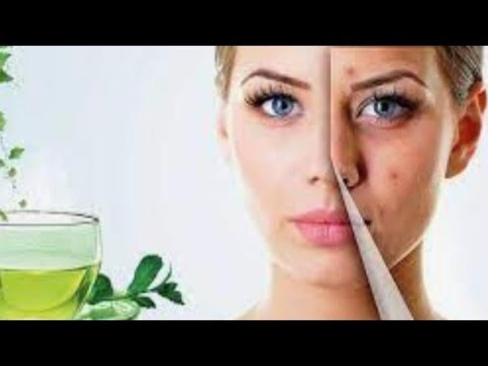 فوائد الشاي الأخضر للعناية بالبشرة