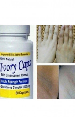ايفوري كابس للتبييض