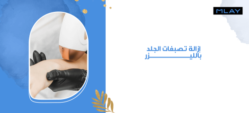 إزالة تصبغات الجلد بالليزر