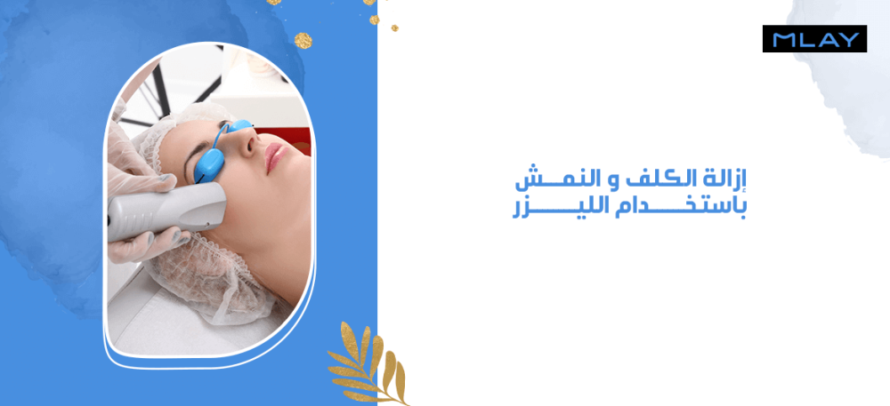 إزالة الكلف و النمش باستخدام الليزر