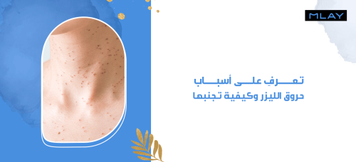 تعرفِ على أسباب حروق الليزر وكيفية تجنبها