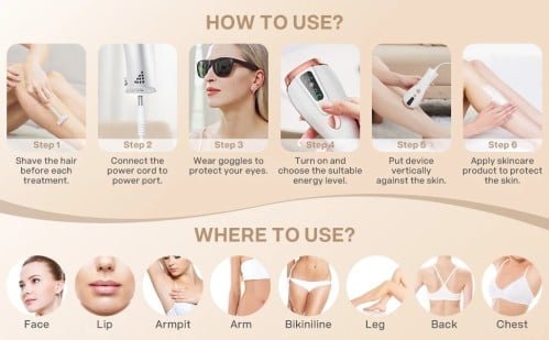 الليزر المنزلي