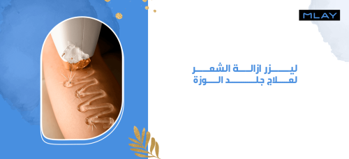 ليزر ازالة الشعر لعلاج جلد الوزة