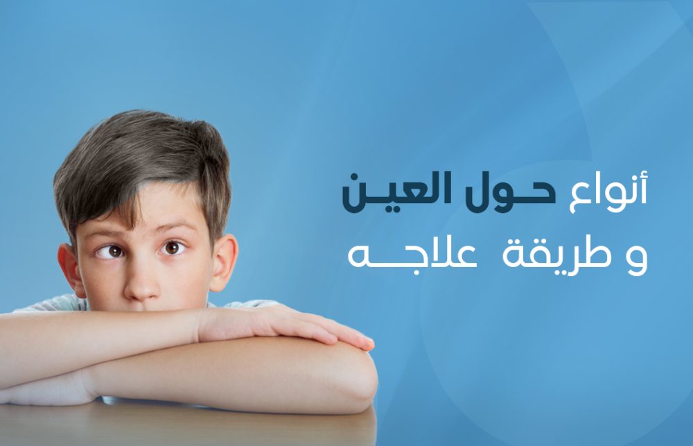 انواع الحول وعلاجه انواع الحول وعلاجه