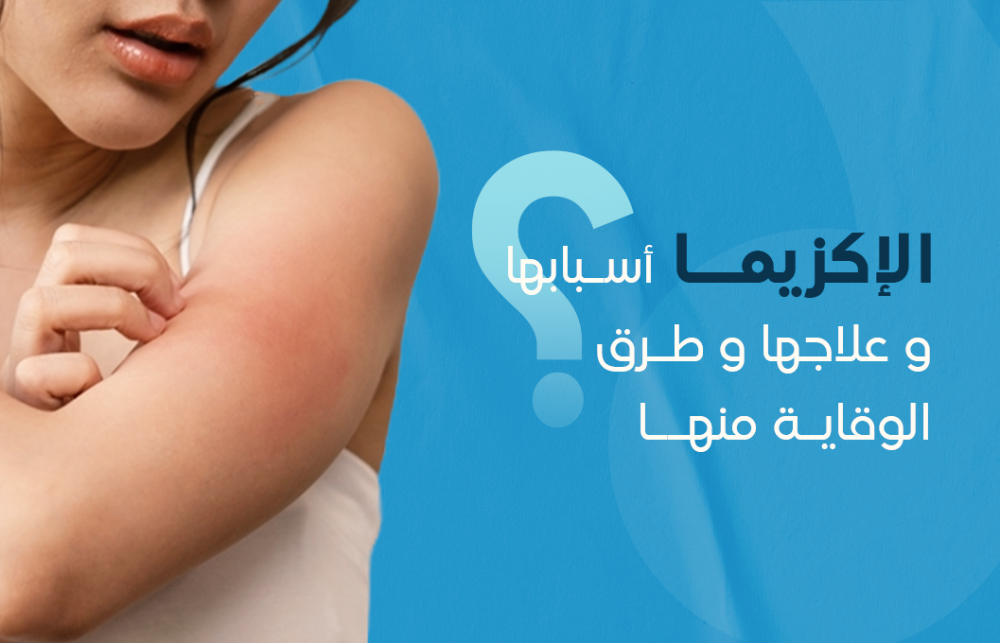 الإكزيما وأسبابها وعلاجها وطرق الوقاية منها
