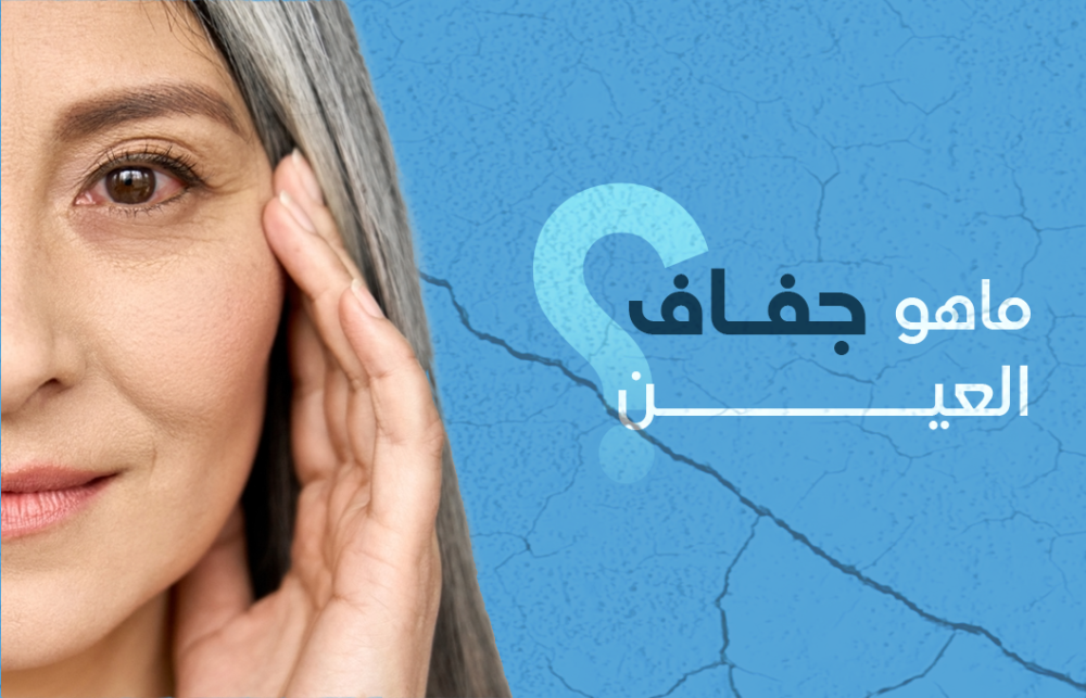 ما هو جفاف العين ؟