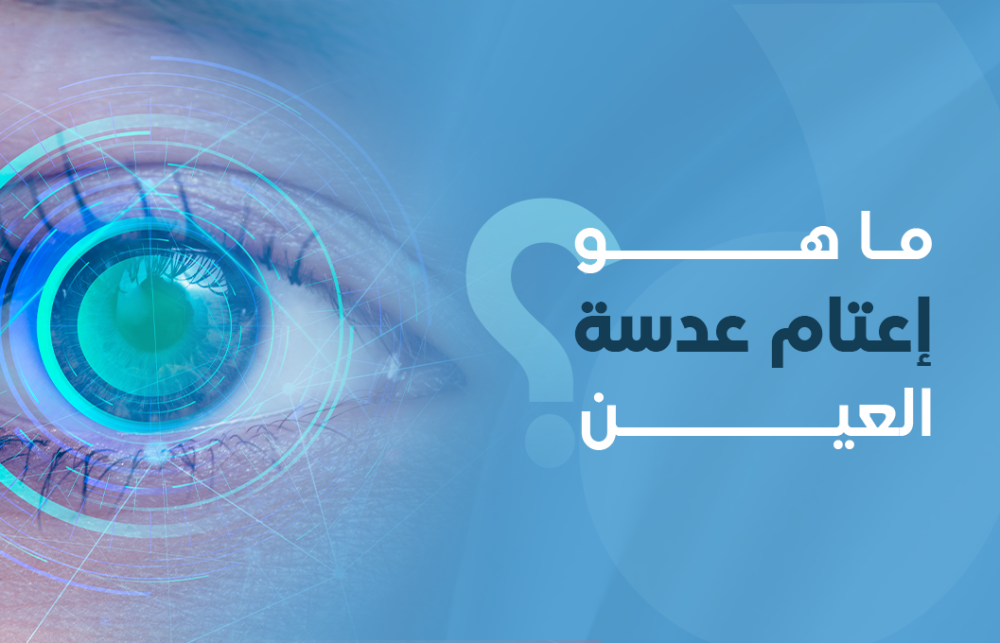 ما هو إعتام عدسة العين؟