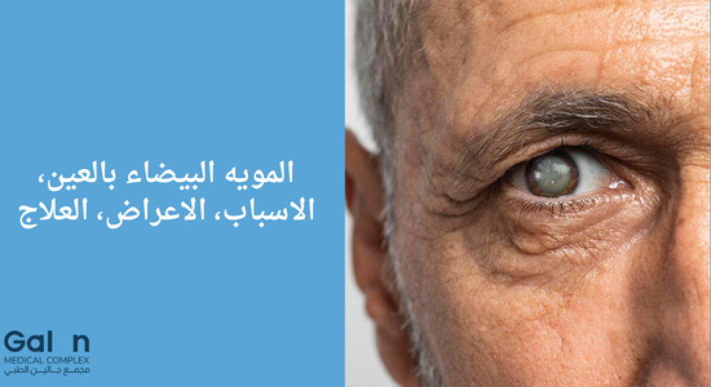 شكل العين المصابة بالمياه البيضاء