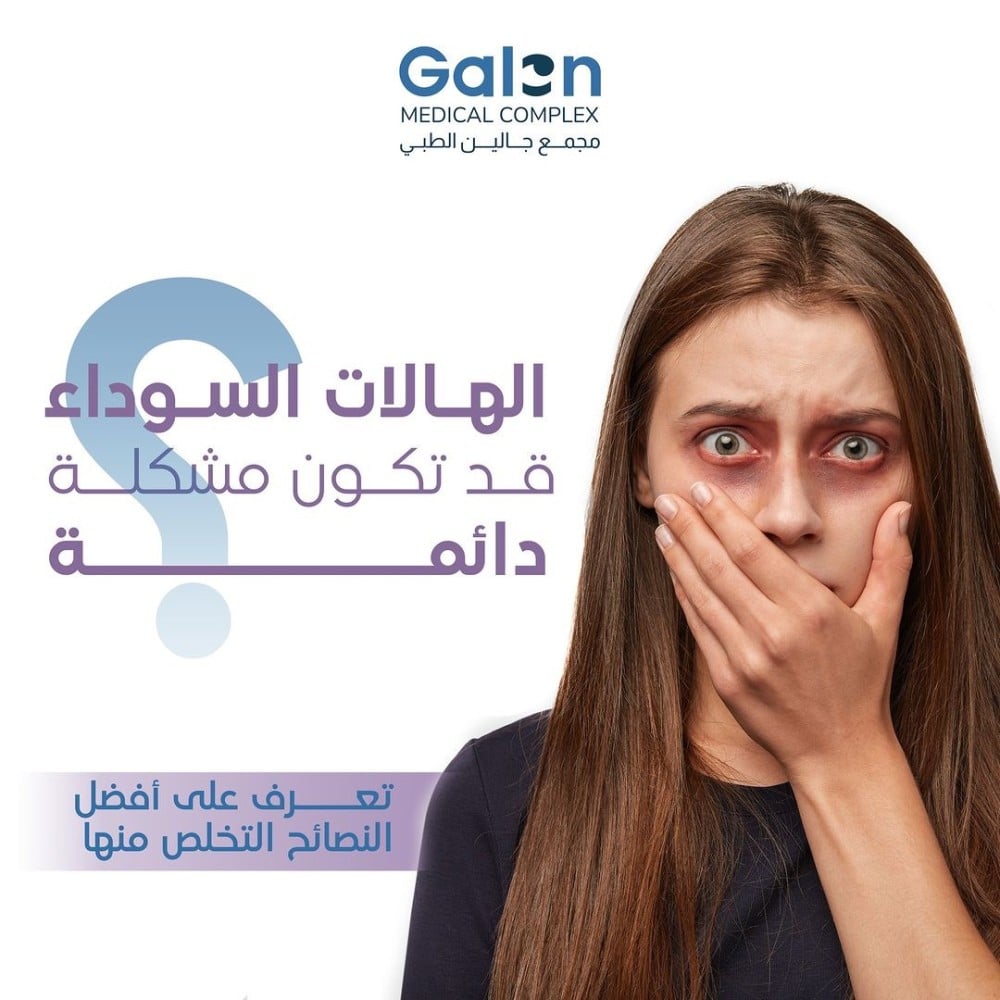 الهالات السوداء وطرق علاجها