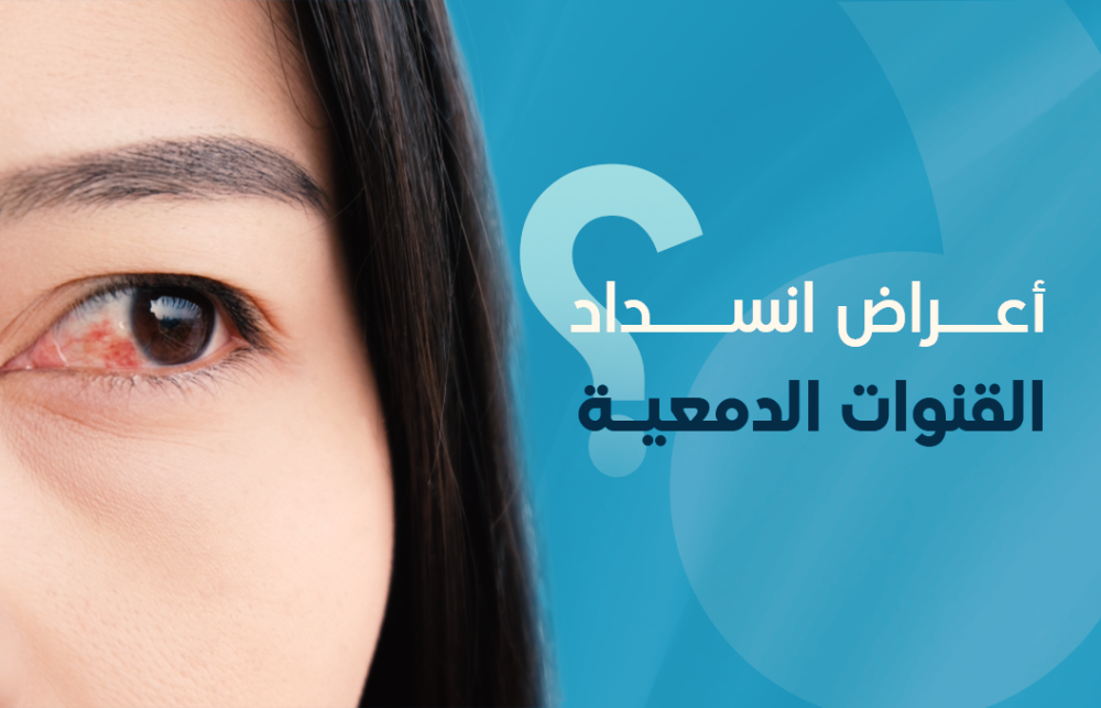 أعراض انسداد القنوات الدمعية