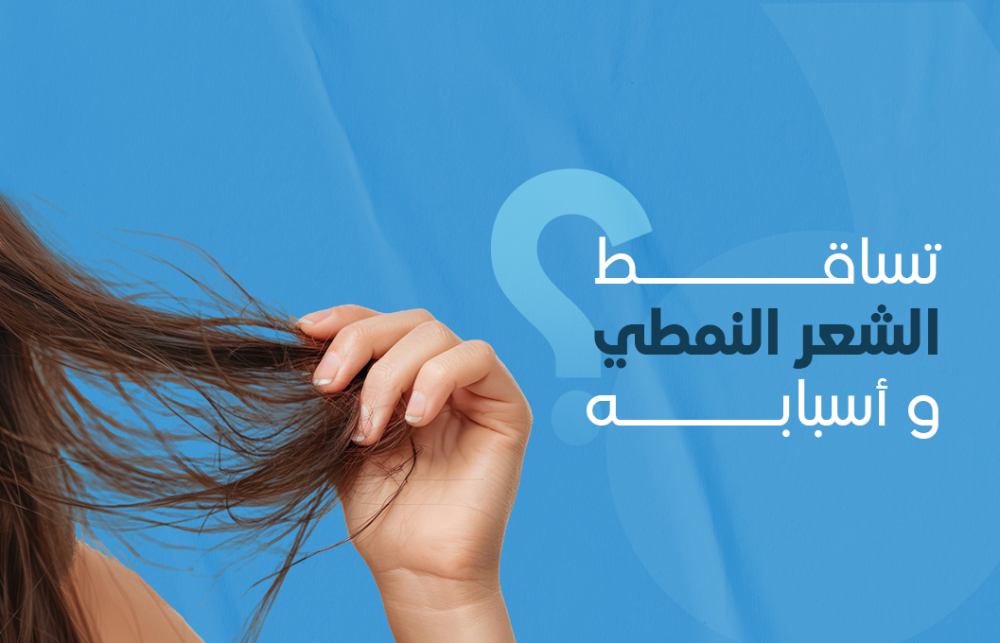 تساقط الشعر النمطي وأسبابه