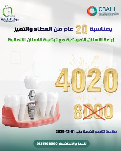 زراعة الاسنان الامريكية مع تركيبة الاسنان الالمانية