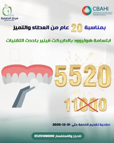 ابتسامة هوليوود بالدايركت فينيير باحدث التقنيات