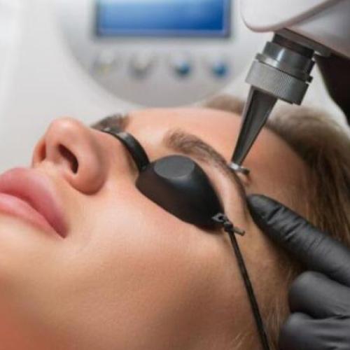 تشقير الوجه