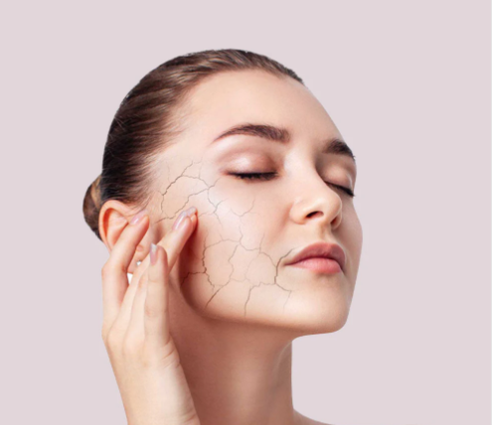 لا تدعي الجفاف يفسد بشرتك