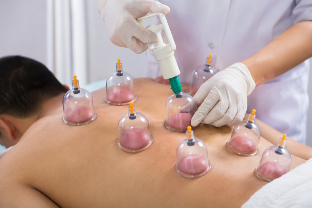 لماذا تعتبر الحجامة الطبية من أفضل العلاجات الطبيعية؟