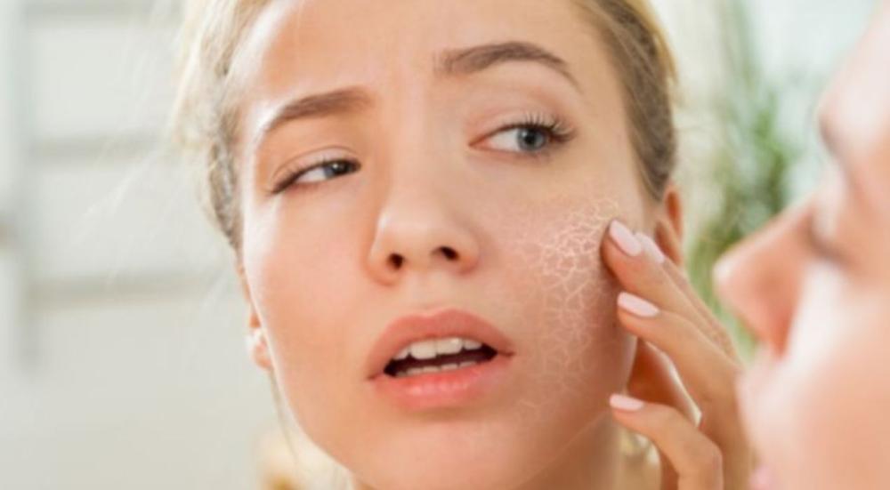 أسباب جفاف البشرة وعلاجها