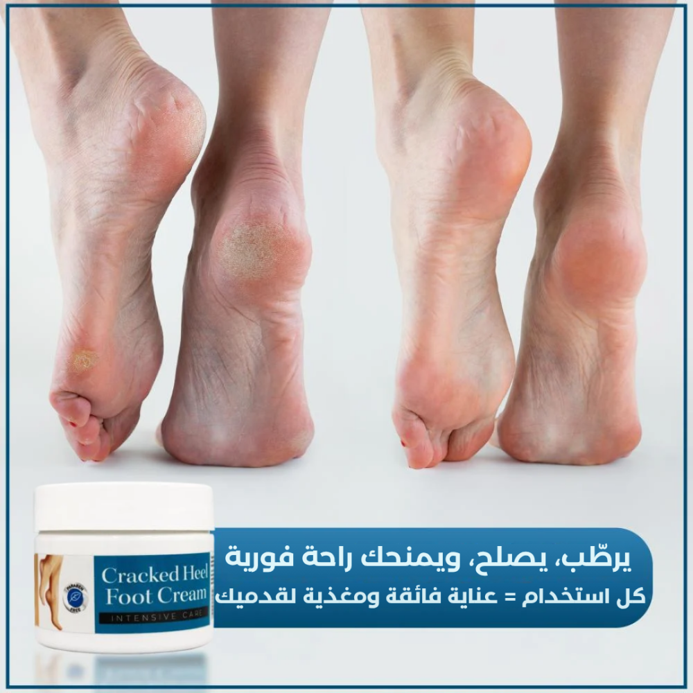 كريم لتشققات القدم من ألفانسو ALVANSO Cracked Heel foot 100ml