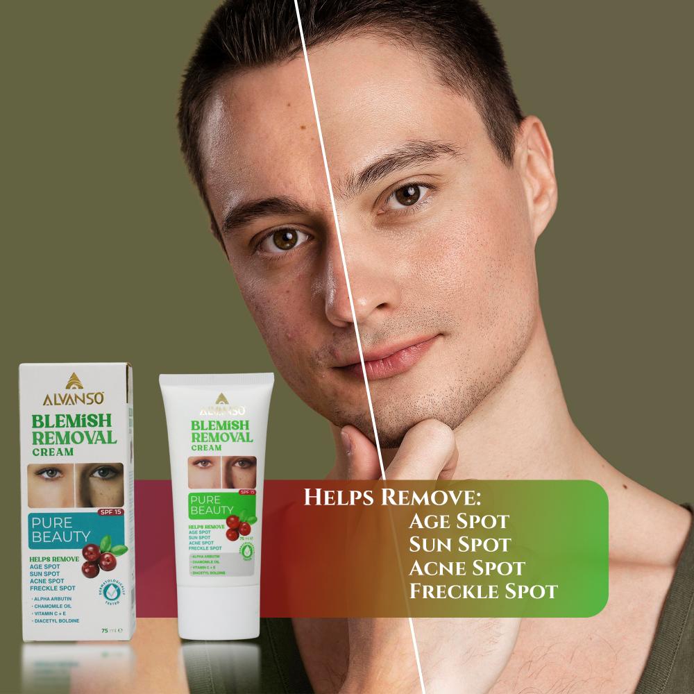 كريم ازالة العيوب