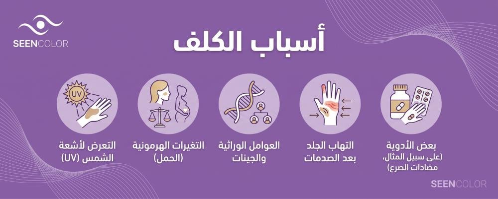 أسباب الكلف