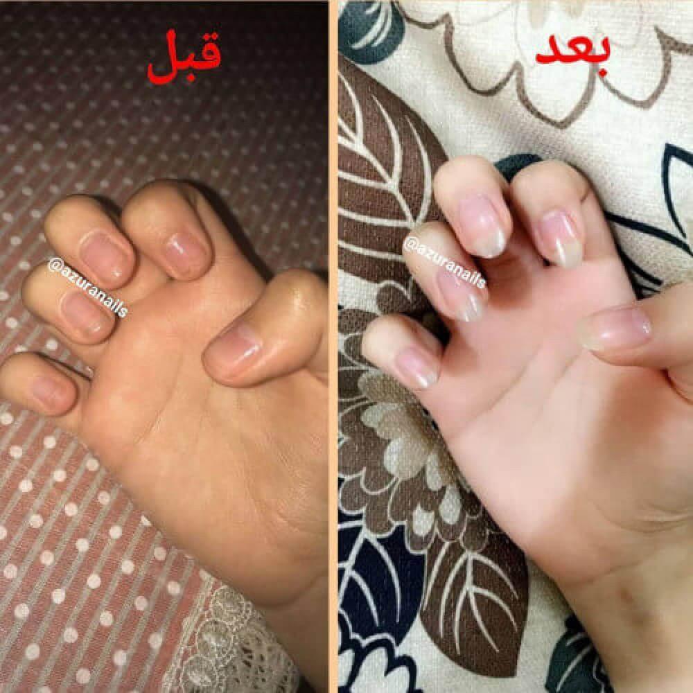 ازورا مقوي الأظافر + ازورا مزيل طلاء الأظافر