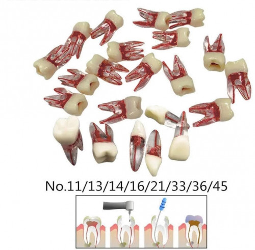 Transparent root canal teeth Different Size