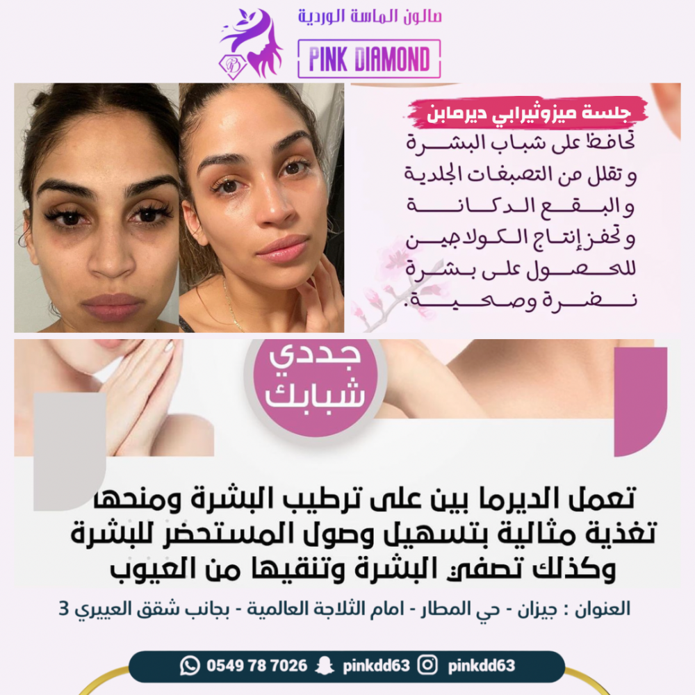 ميزو ثيرابي لنضارة البشرة
