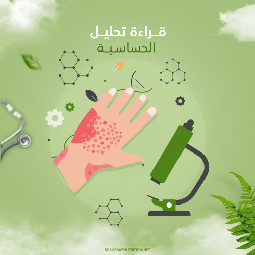قراءة تحليل الحساسية