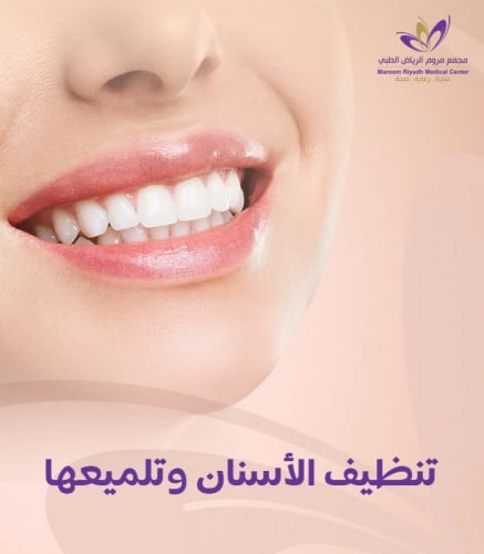 تنظيف وتلميع الأسنان