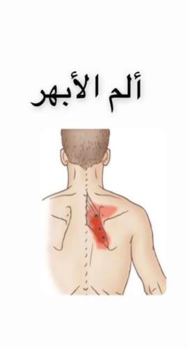 الابهر