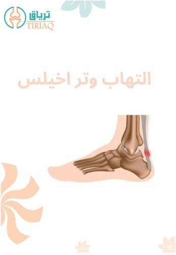التهاب وتر اخيلس