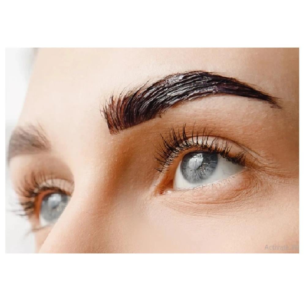 بوتكس رفع الحواجب وحول العين