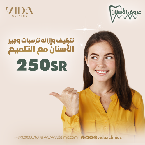 جلسة تنظيف الاسنان