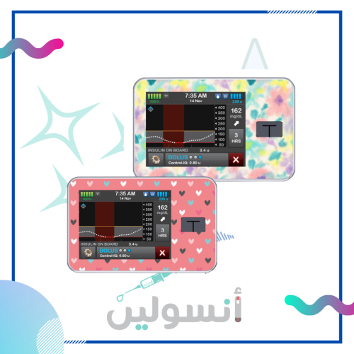 ستكر مضخة  تانديم