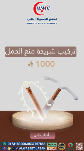 تركيب شريحة منع الحمل