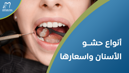 أنواع حشو الأسنان واسعارها | خيارات حشو الأسنان