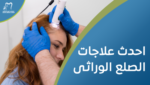احدث علاجات الصلع الوراثى لعام 2025