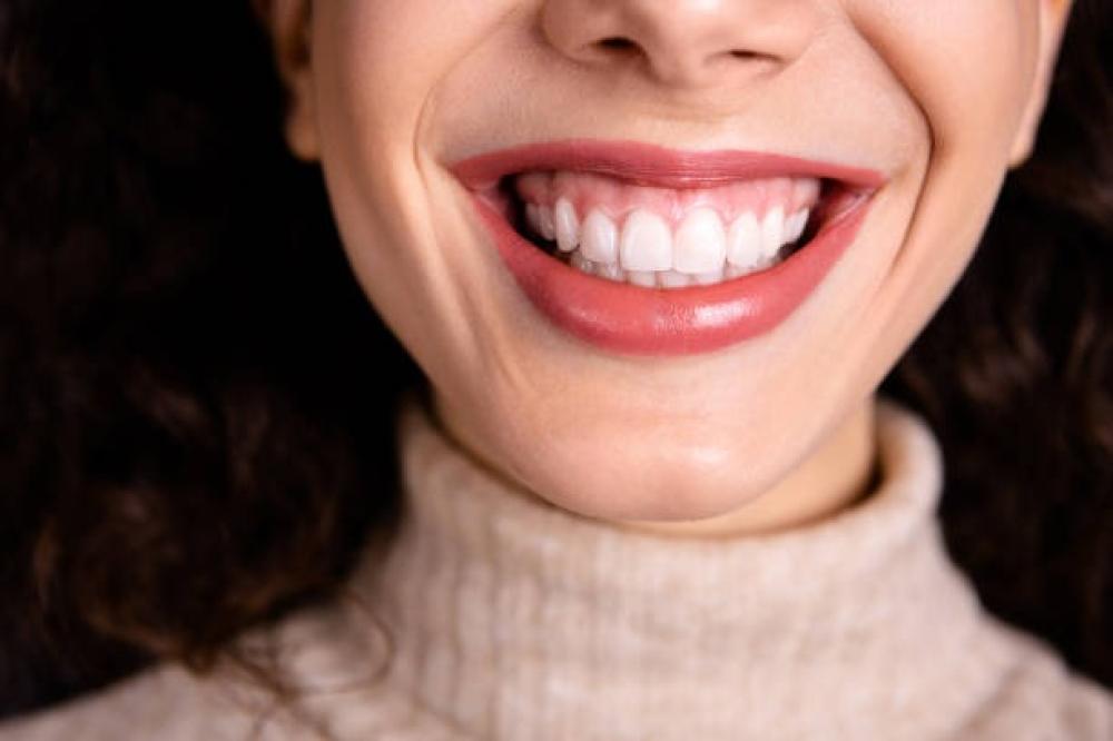 علاج الابتسامة اللثوية بدون جراحة
