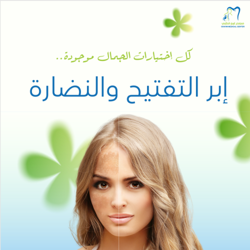 إبرة النضارة الملكية