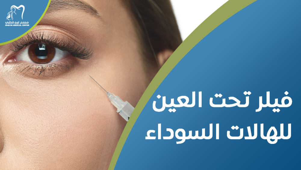 فيلر تحت العين للهالات السوداء