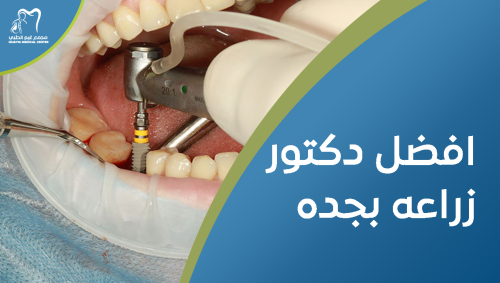 افضل دكتور زراعه بجده, استعد ابتسامتك بثقة
