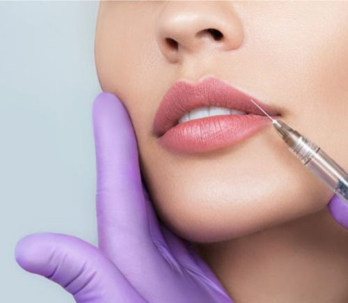 ١ مل فیلر توسیال