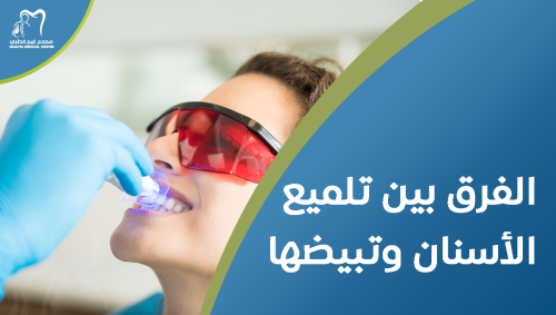 الفرق بين تلميع الأسنان وتبيضها | العناية بالفم