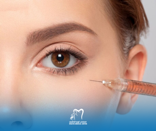 فيلر انوفيال