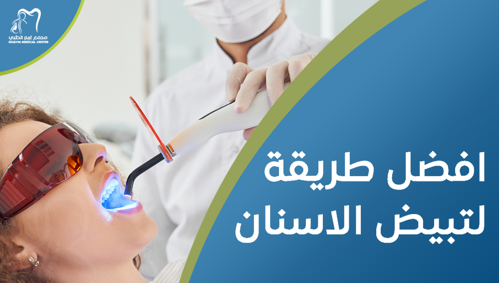 افضل طريقة لتبيض الاسنان