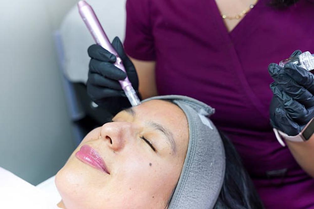 جلسات الديرما بن للبشره