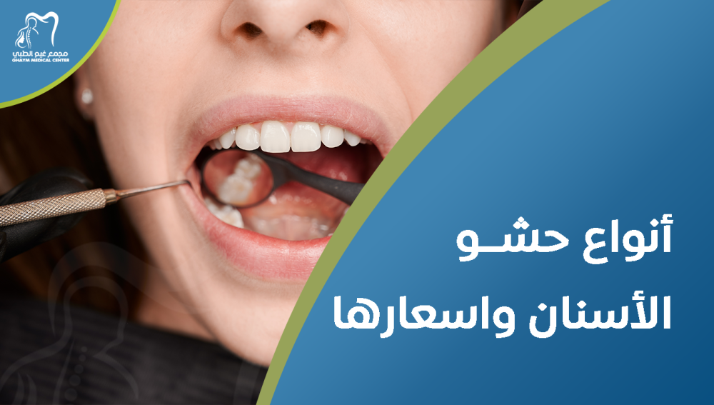 أنواع حشو الأسنان واسعارها