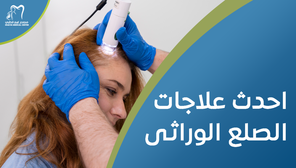 احدث علاجات الصلع الوراثى